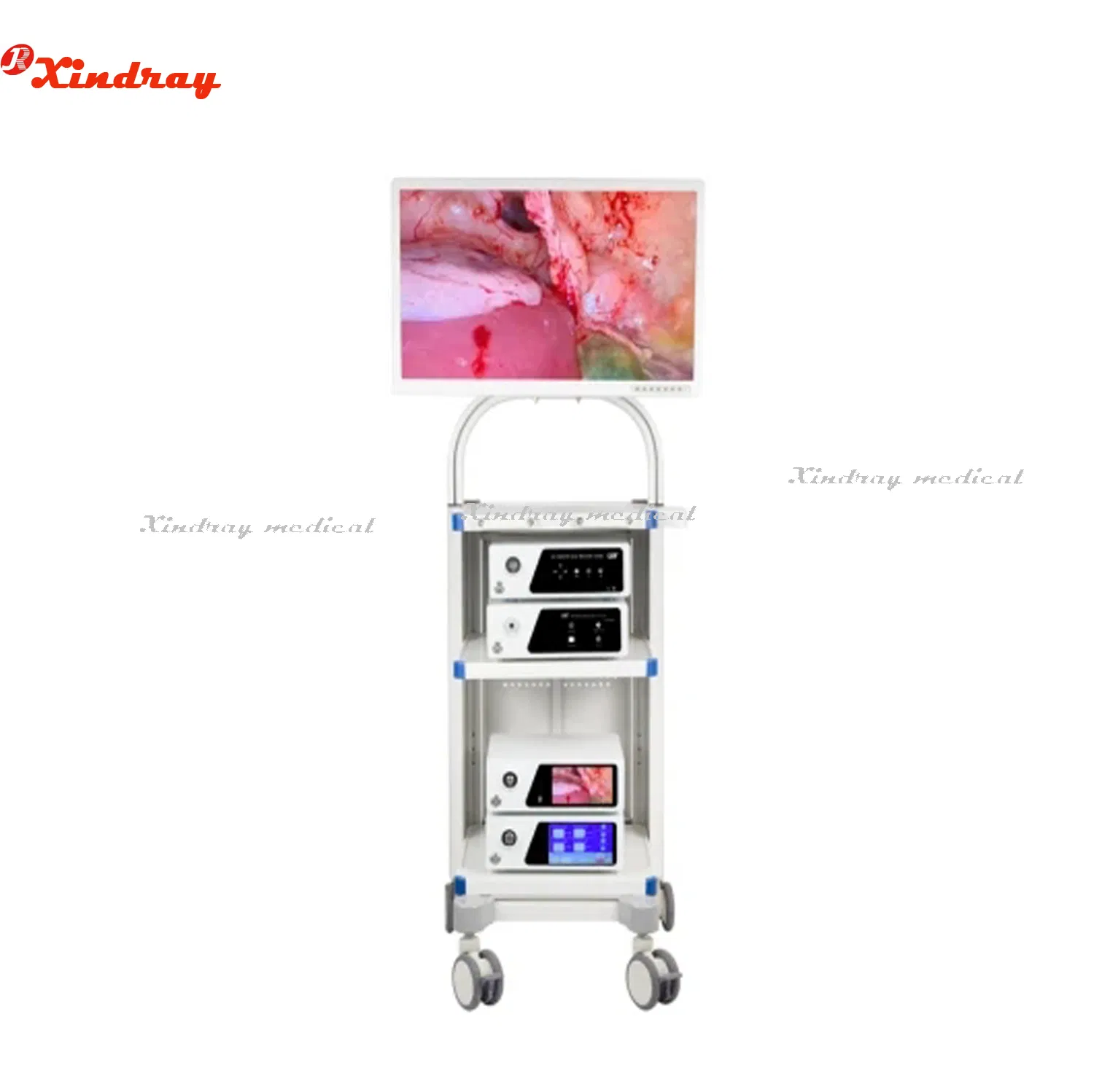 4K FHD Endoscope Camera System for Rigid Laparoscopy