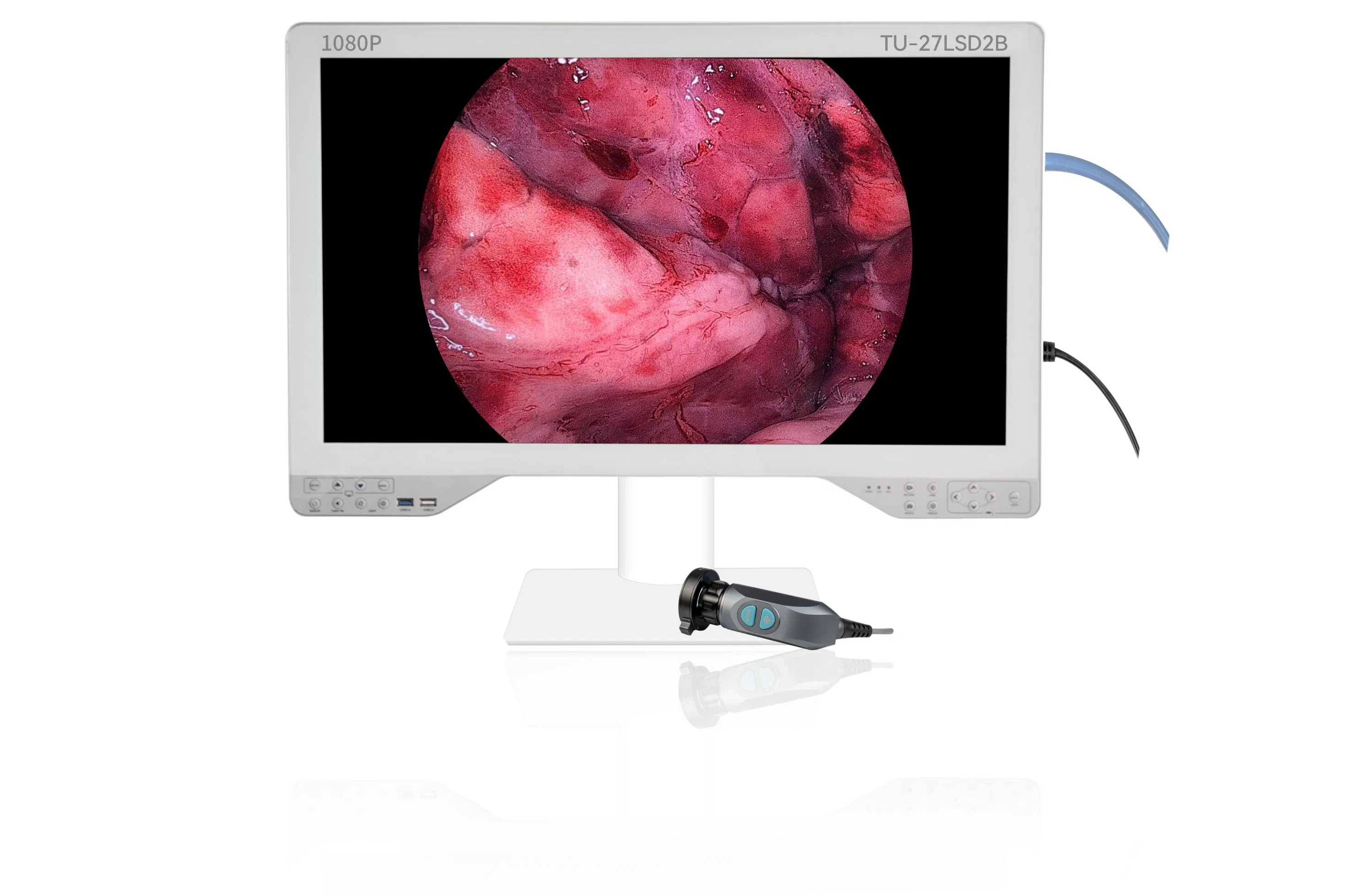 Endoscope Light Source 1080P HD Digital Video Recording Laparoscopy Camera Display System with All in One 27 Inch Monitor