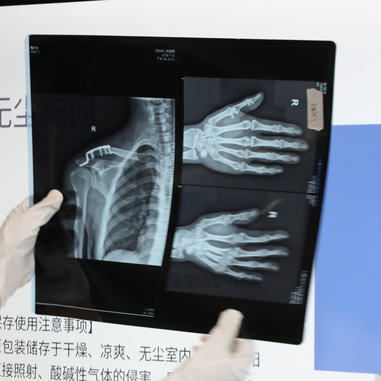 Shenmu High Density Fast-Processing Medical Dry Imaging Film