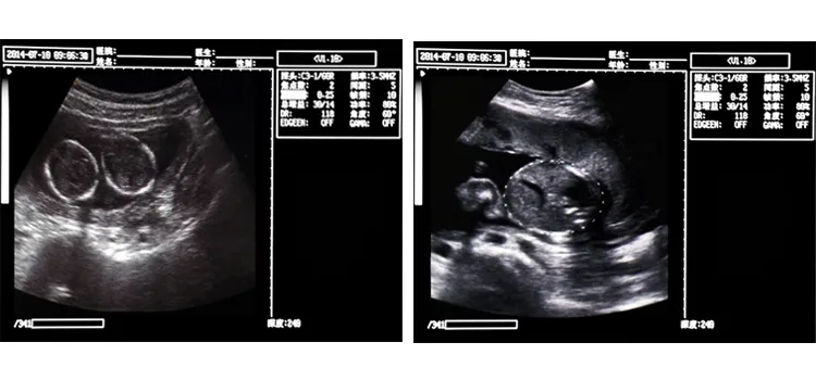 Ultrasound Imaging System Interface