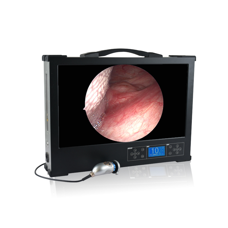 Customizable Portable Endoscope System with Light Source