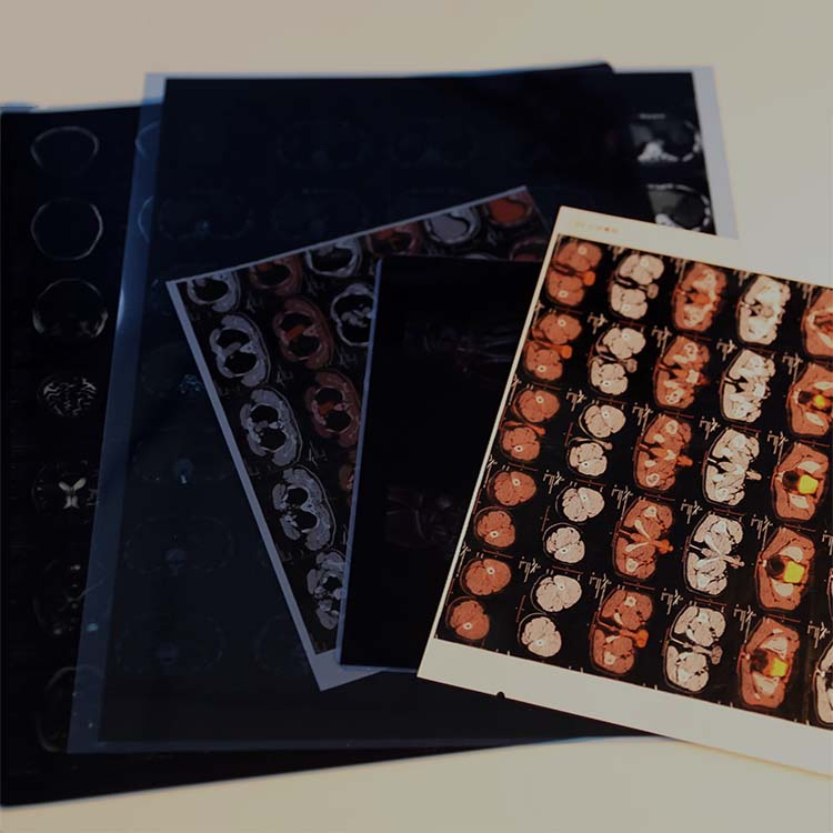 Advanced Medical Dry Imaging High Density Clear Image Film