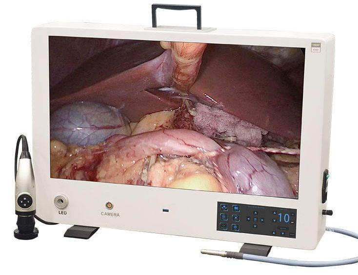 Portable FHD Laparoscopic All in One Endoscope Camera System for Ent Urology Gynecology
