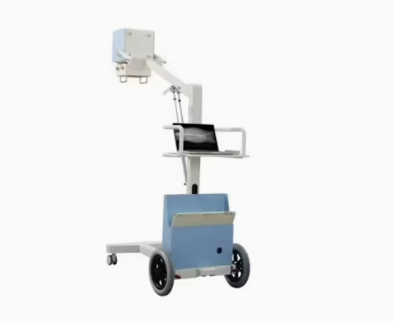 Compact High-Frequency Portable X-ray Film Imaging Diagnostic Medical Device