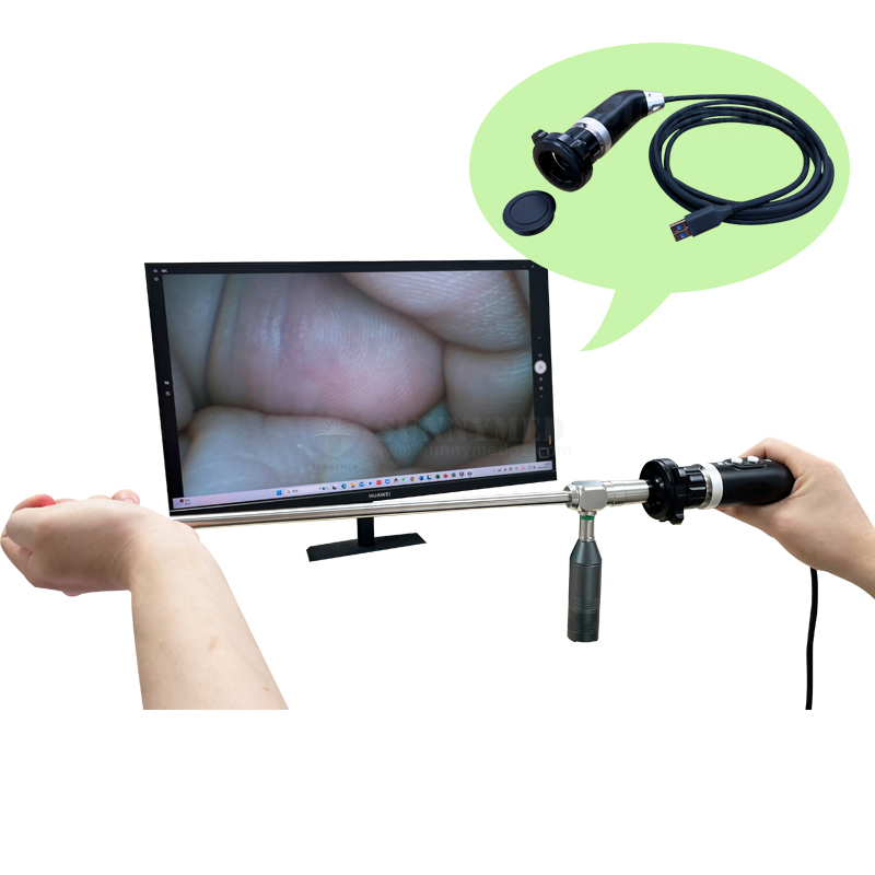 Sy-P031HD4 Handheld 1080P Full HD USB Endoscope Camera System for Rigid/Flexible Endoscope Ent Surgery