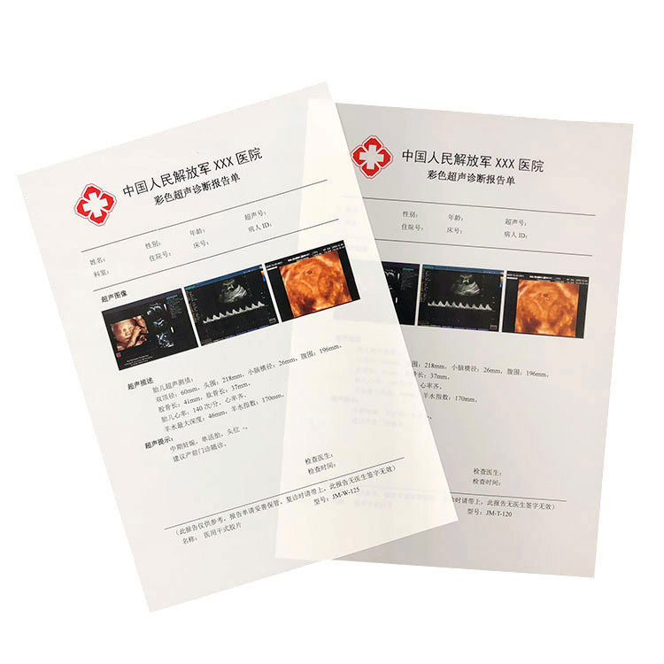 Modern Medical Dry Imaging High Resolution Clear Image Cost-Effective Film