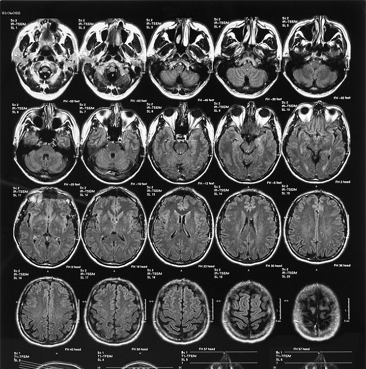 Efficient Medical Dry Imaging High Resolution Durable Film