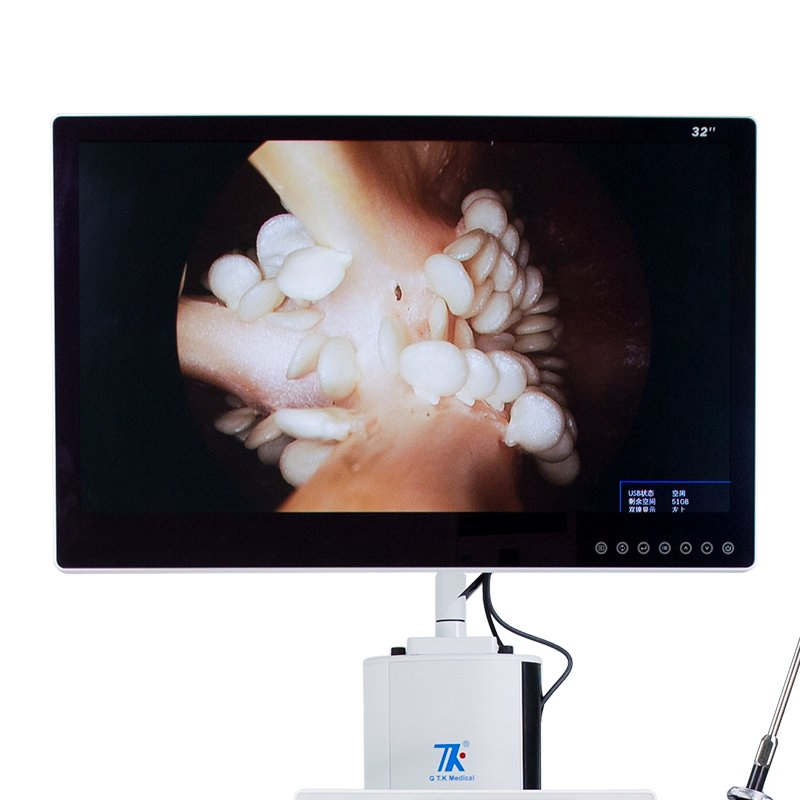 Hot Selling Portable Ent Endoscope Camera System with Light Source Mdr CE