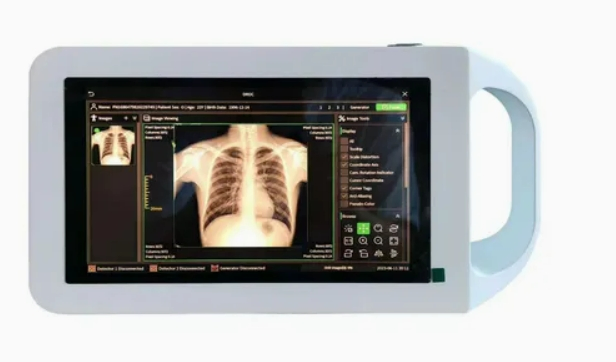 Handheld High-Frequency Medical X-ray Imaging Device