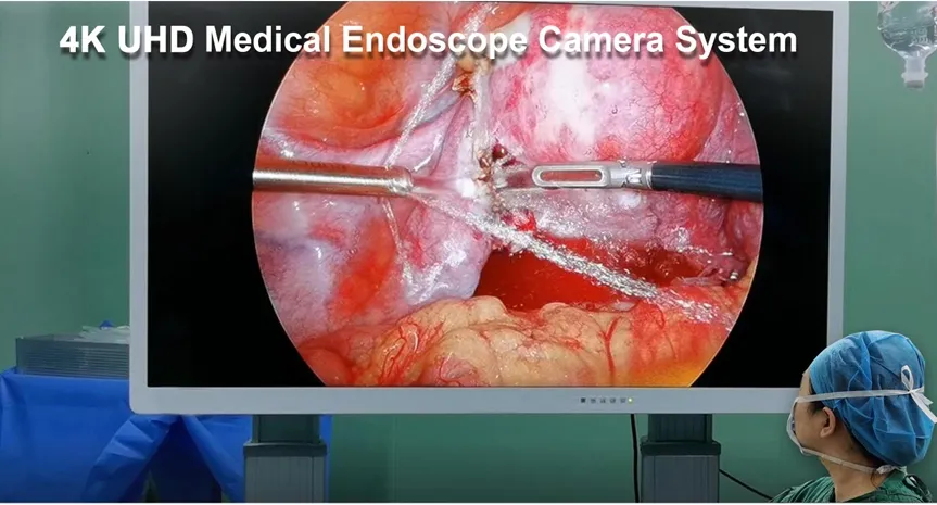 Endoscopic Imaging