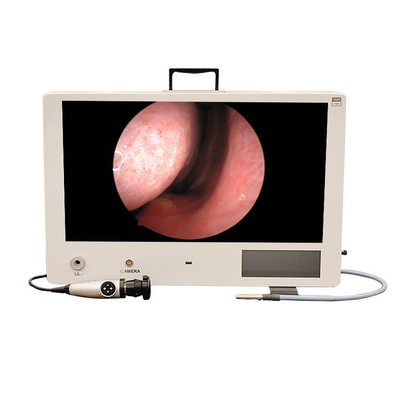 Portable FHD Laparoscopic All in One Endoscope Camera System for Ent Urology Gynecology