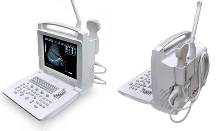 Factory Direct Sales Black and White Digital Ultrasonic Imaging System