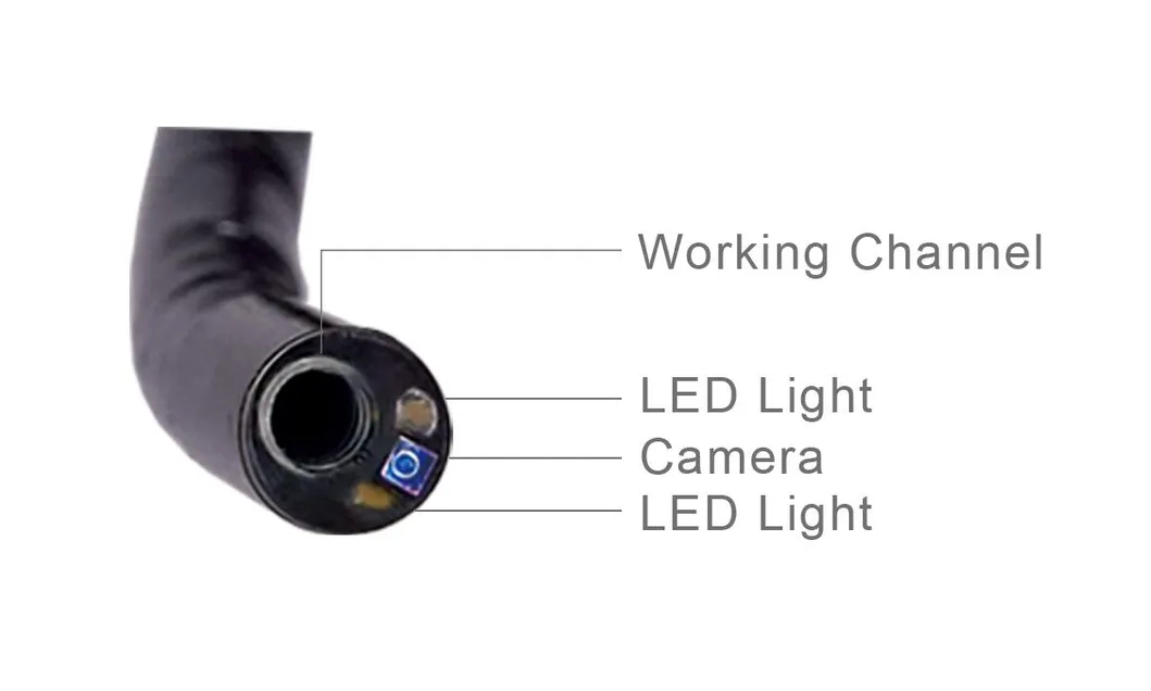 HD Endoscopic Camera System