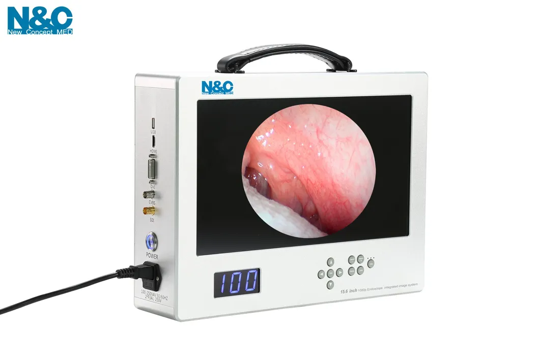 Integrated Endoscope Camera System 1