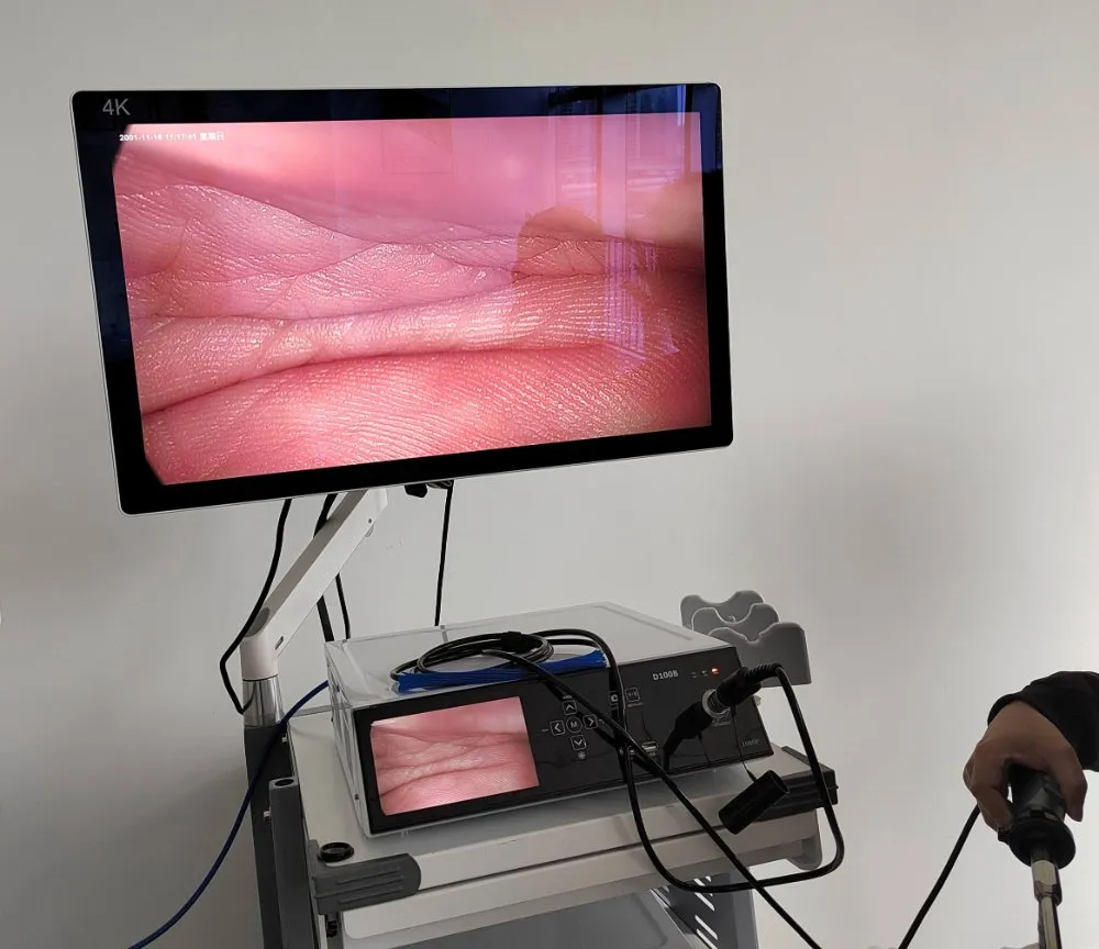 HD Endoscopic Imaging