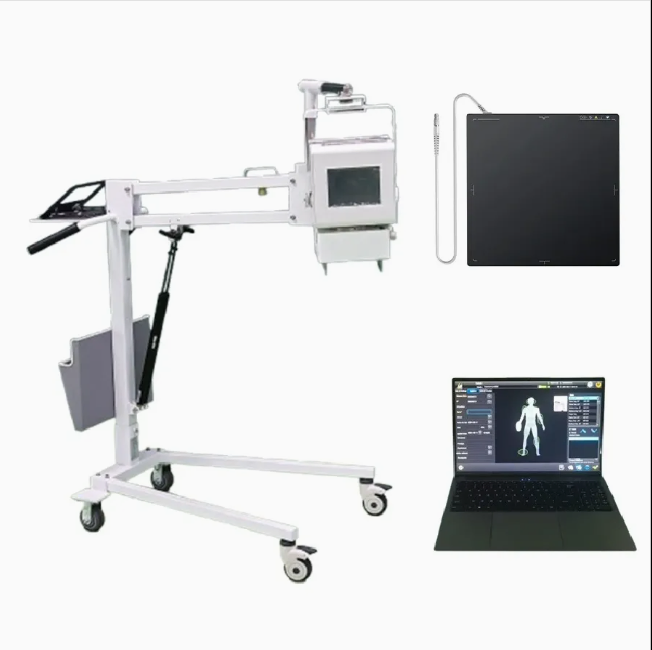 High-Quality Portable Xray System - Ideal Medical Imaging for Clinics and Hospitals