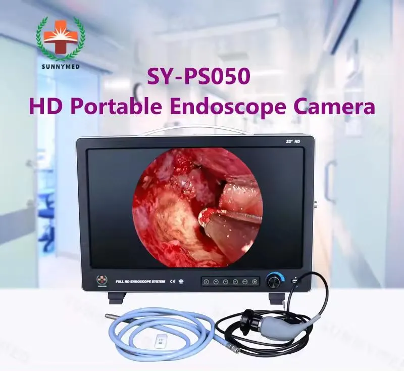 Endoscope View 1