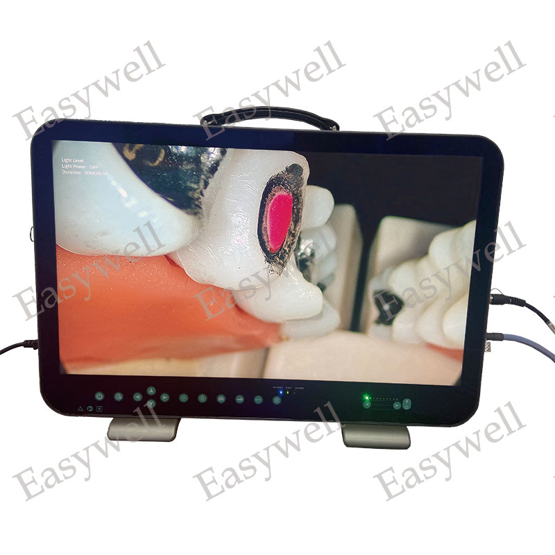 Easywell 3 in 1 4K Endoscopic Imaging System E43 for Medical Endoscope