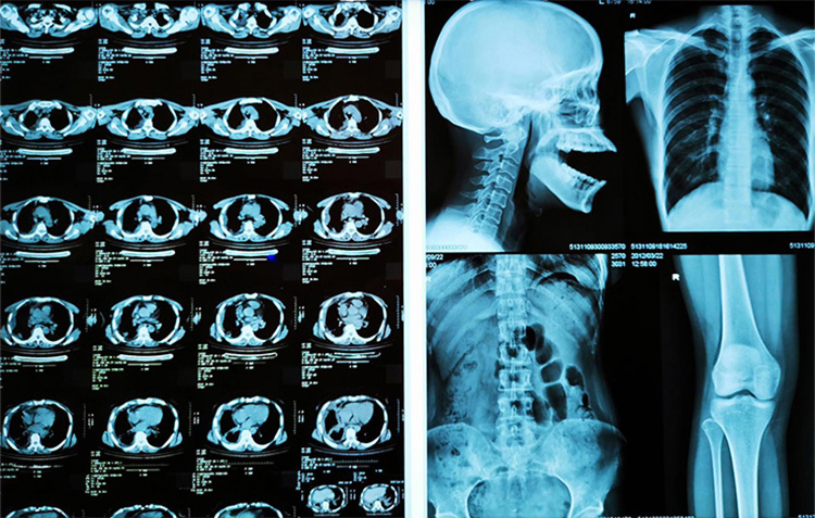 Advanced Medical Dry Imaging High Density Clear Image Film