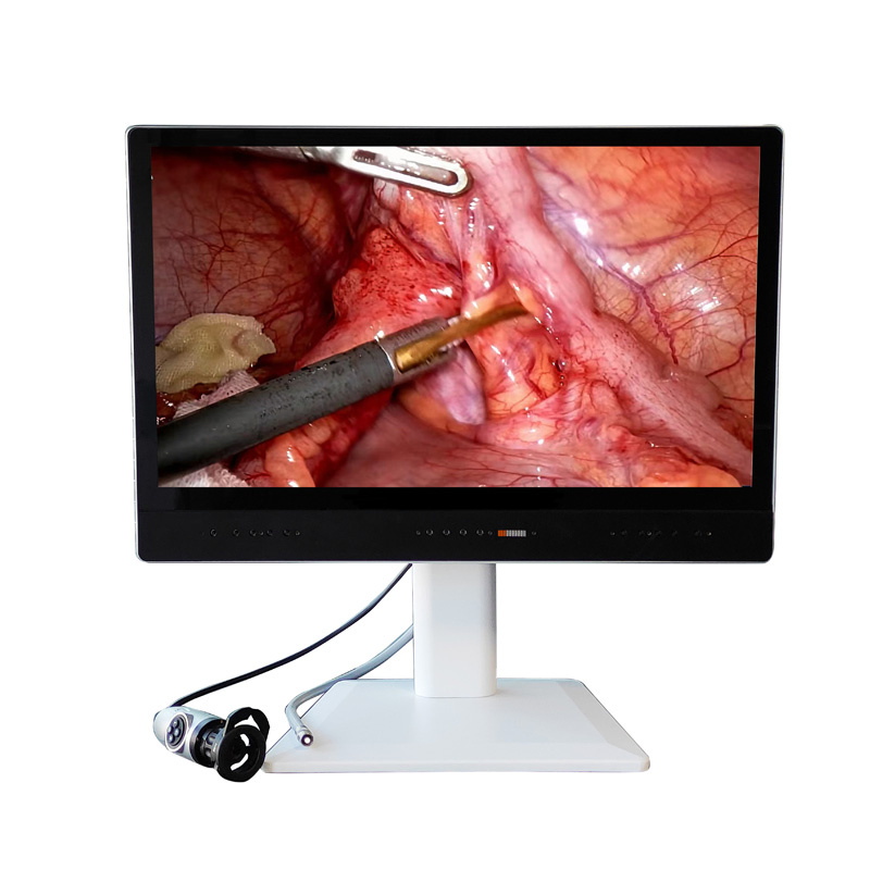 24inch Endoscope Camera System with Medical Grade Monitor