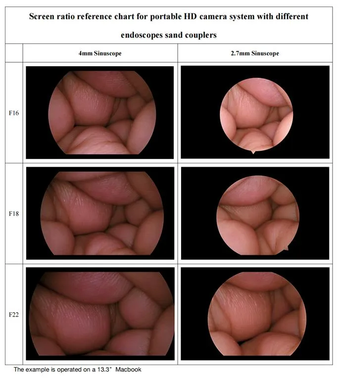 Screen Ratio Chart