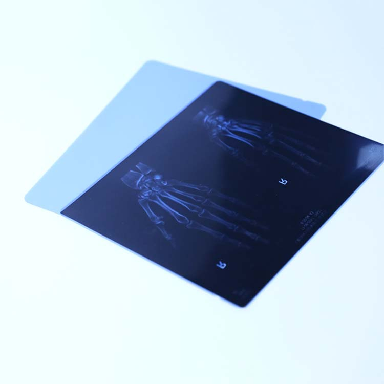 Shenmu High Density Fast-Processing Medical Dry Imaging Film