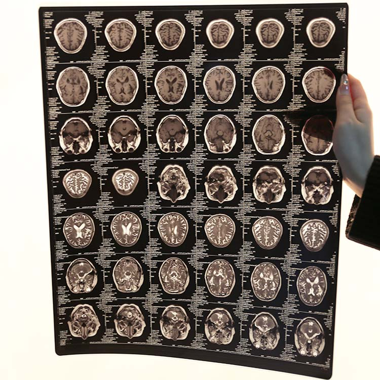 Advanced Medical Dry Imaging High Density Clear Image Film