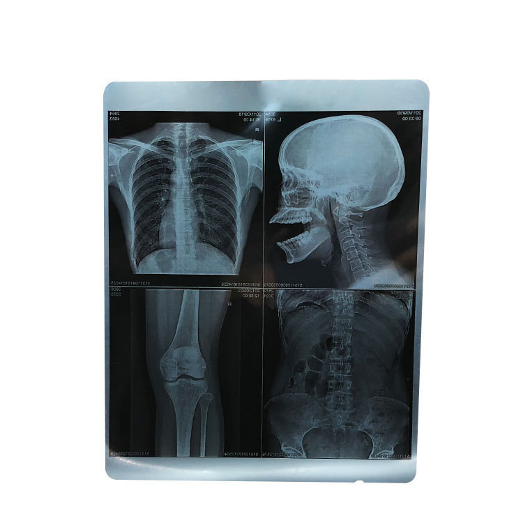 Long Life Medical Dry Imaging High Density Clear Image Cost-Effective Film