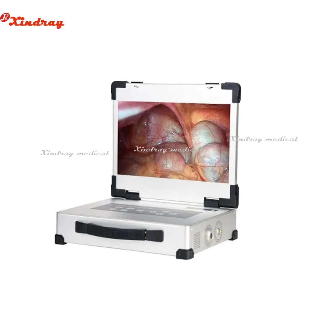 Endoscope Camera System