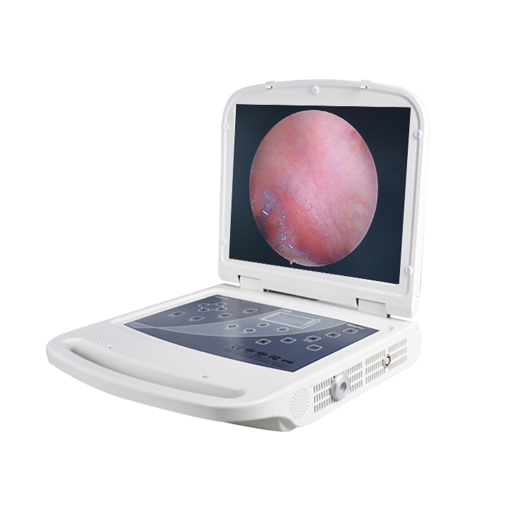 Advanced Affordable Integrated Endoscopic System for Medical Imaging