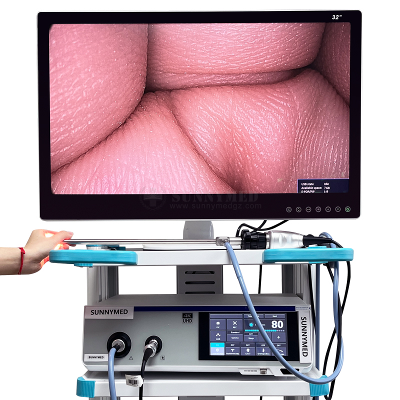 Ultra 4K Endoscope Camera System for Arthroscopy Ent Pted Cystoscope Percutaneous Nephroscope