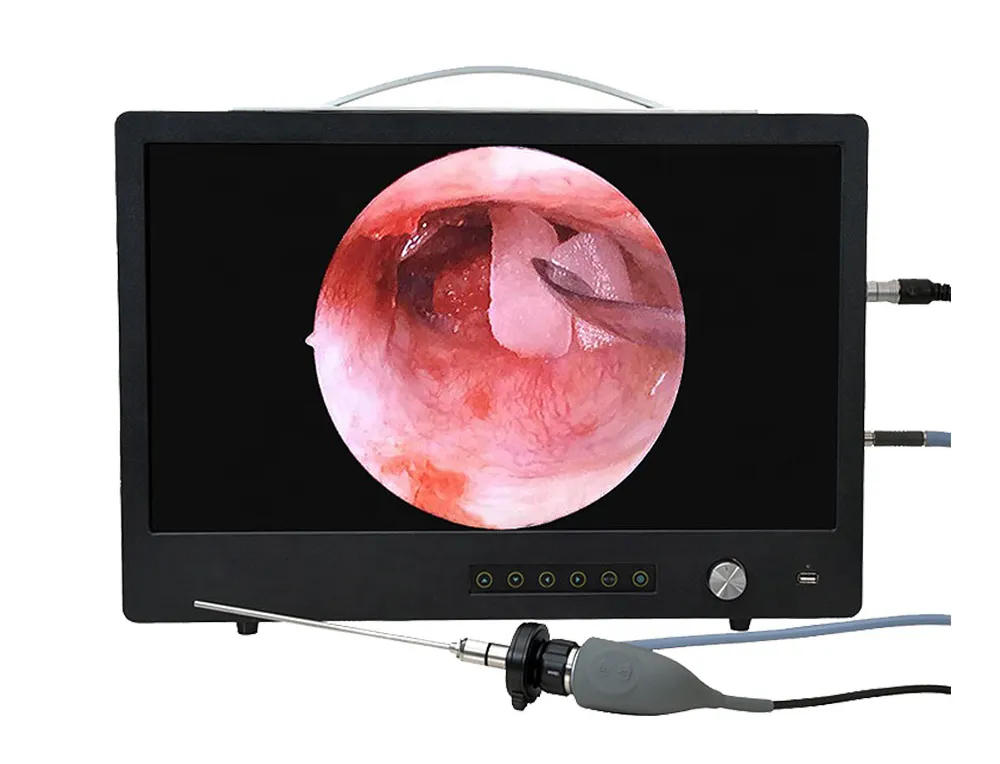 Endoscope System
