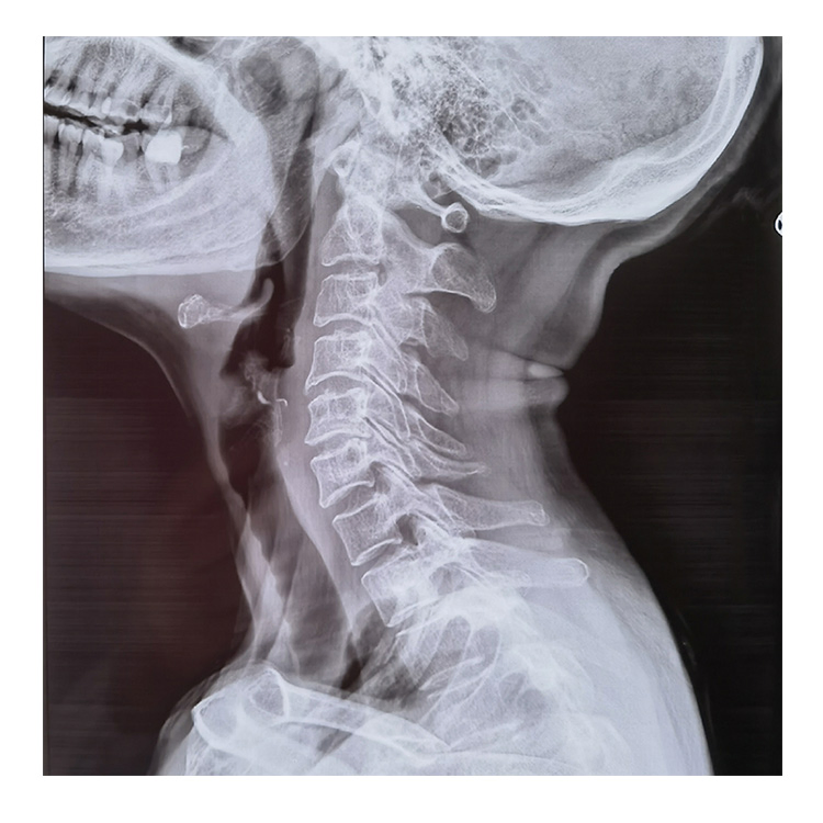 Efficient Medical Dry Imaging High Resolution Long-Lasting Cost-Effective Film