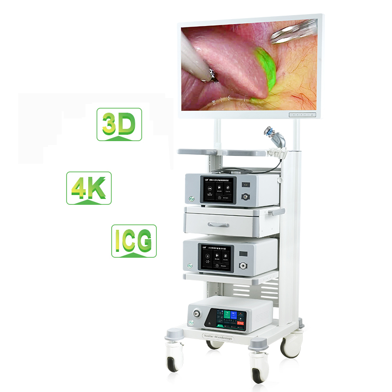 Advanced 4K UHD Medical Endoscope System for Arthroscopy