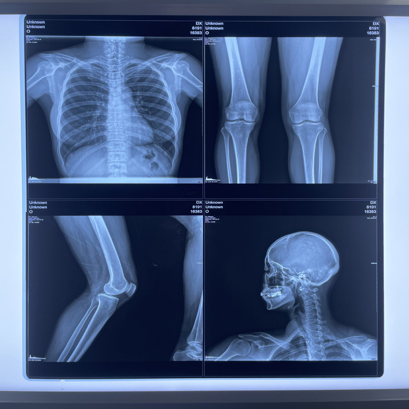 Efficient Medical Dry Imaging High Resolution Long-Lasting Cost-Effective Film