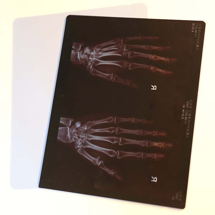 Shenmu High Density Fast-Processing Medical Dry Imaging Film