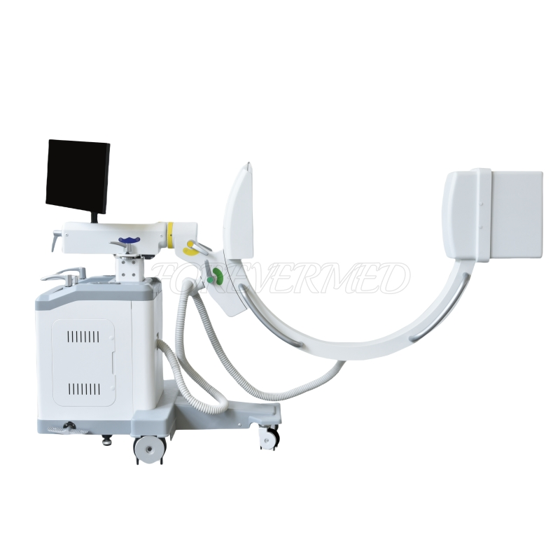 Digital C-Arm 5kw X-ray System for Enhanced Patient Imaging