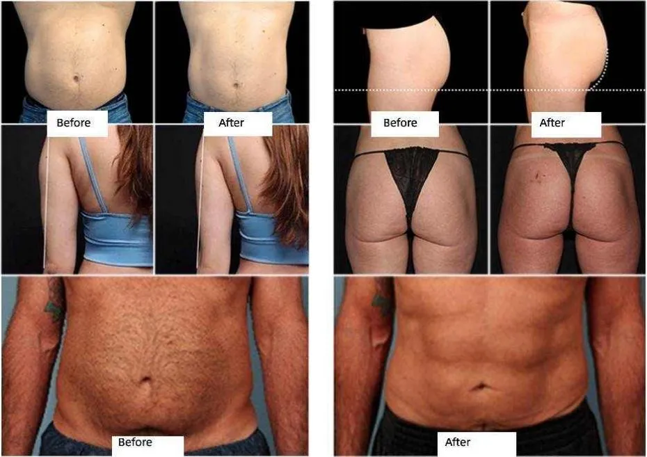 Before and After 2