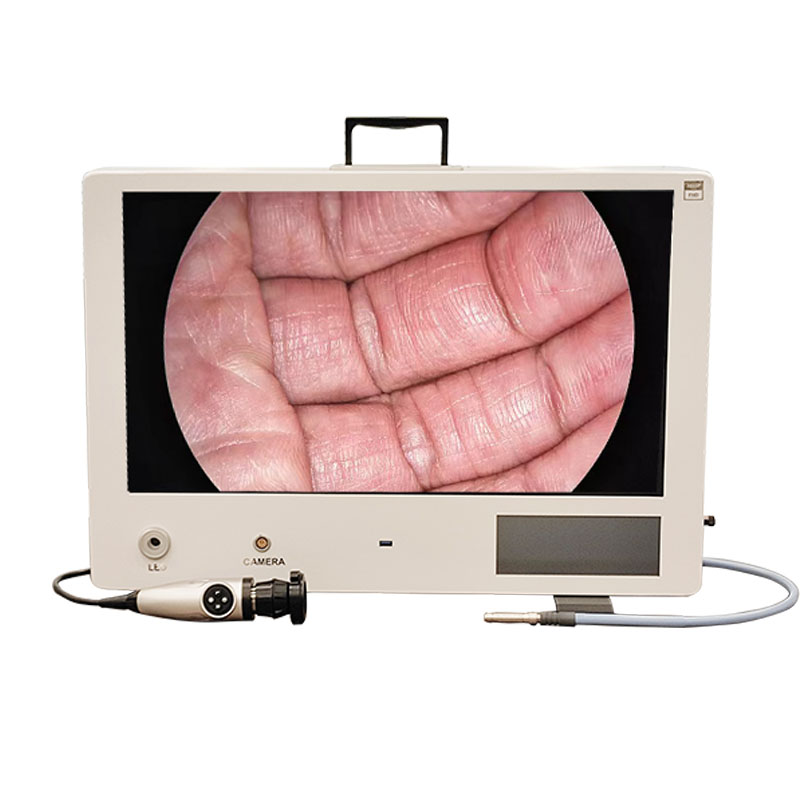 Portable Endoscope Camera System