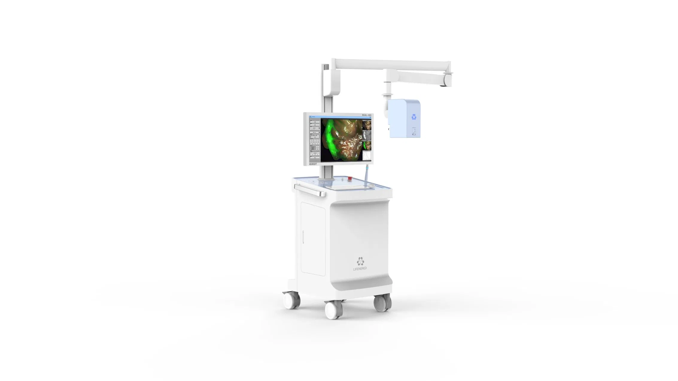 Advanced Fluorescence Imaging Solution for Precise Breast Surgery