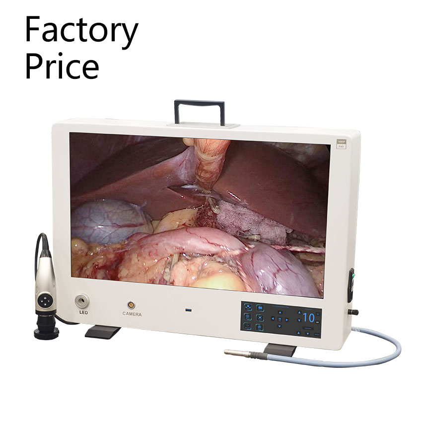 Electric Full HD Medical Endoscopic Camera System with Display and Storage Function for Clinical and Surgical Use