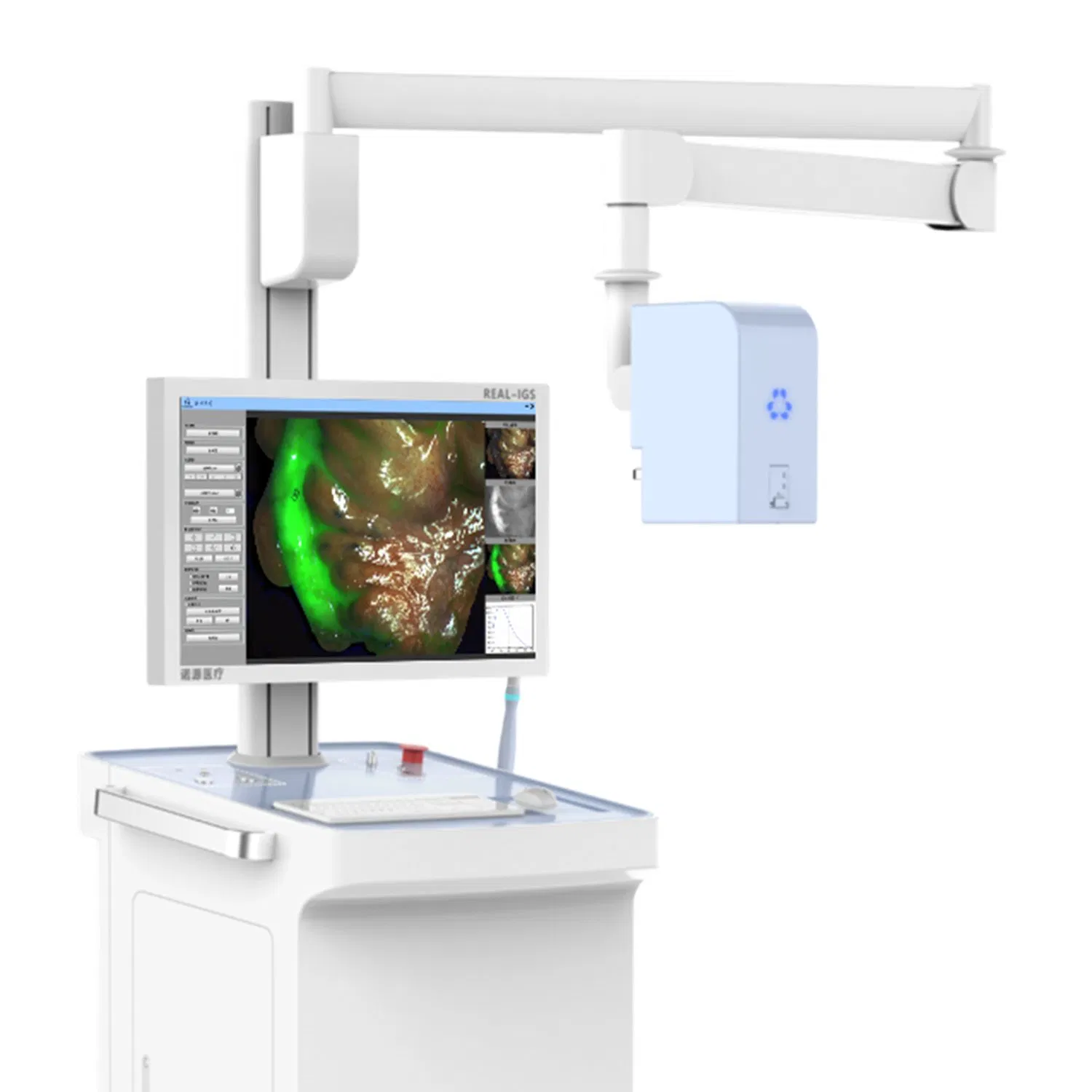 Advanced Fluorescence Imaging Solution for Precise Breast Surgery