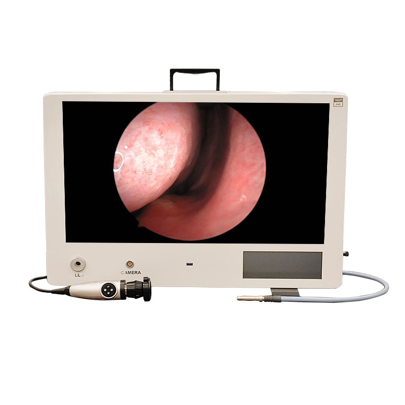 Electric Full HD Medical Endoscopic Camera System with Display and Storage Function for Clinical and Surgical Use