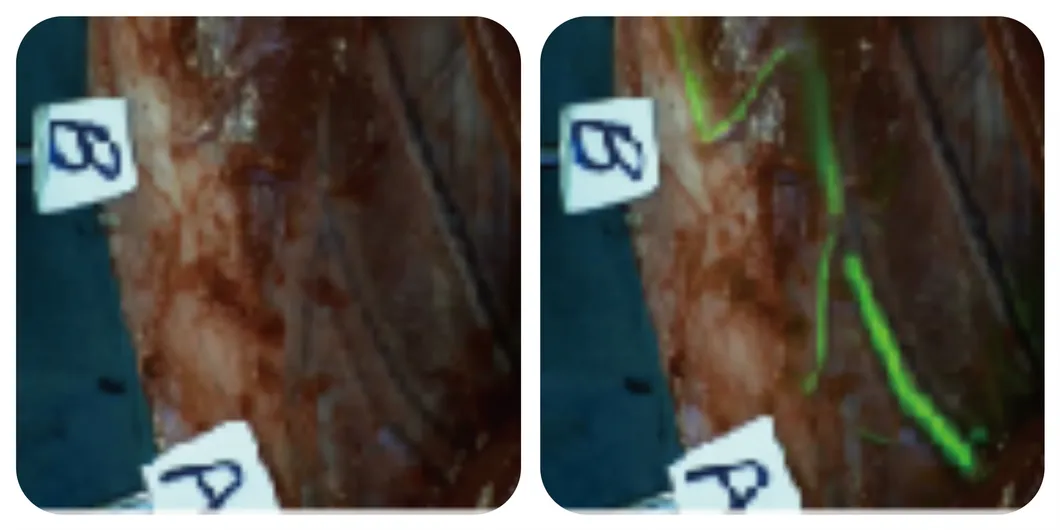 Blood supply assessment