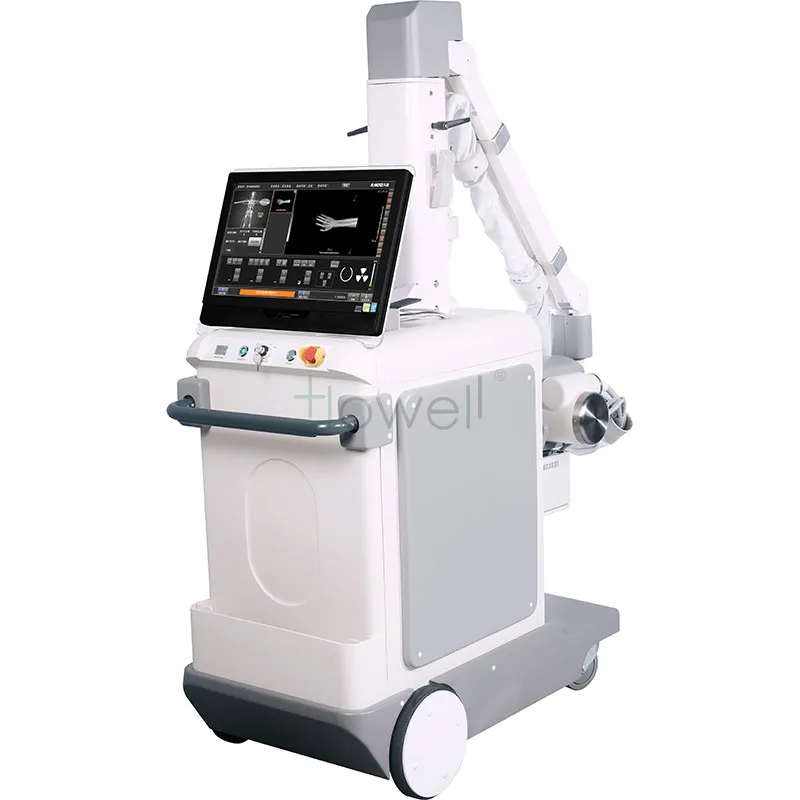 Mobile X-ray Front View