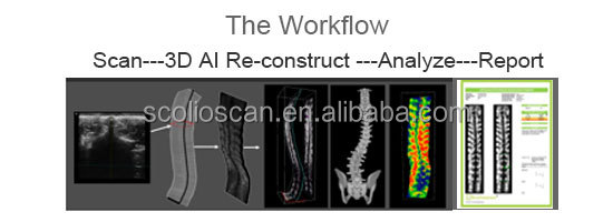Workflow Diagram
