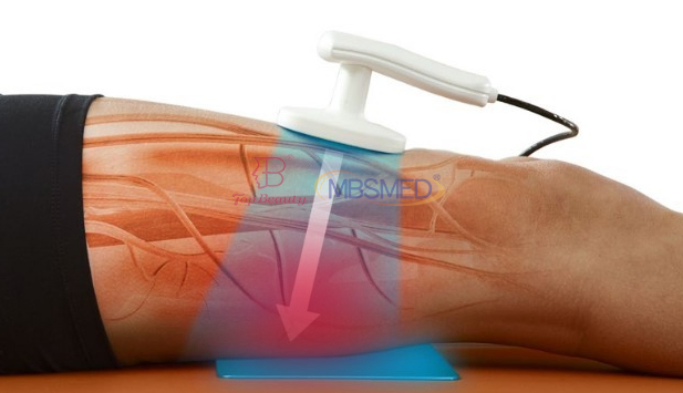 Painless Ret Cet Handle Rehabilitation Pain Relief Physical Therapy Equipment Tecar RF Winback Tecartherapy Physio Tecar Device
