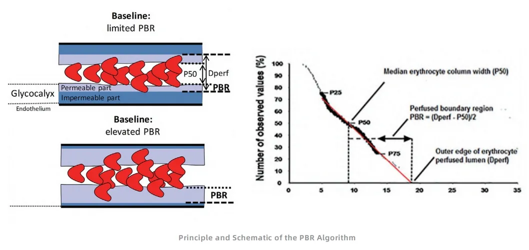 PBR Algorithm