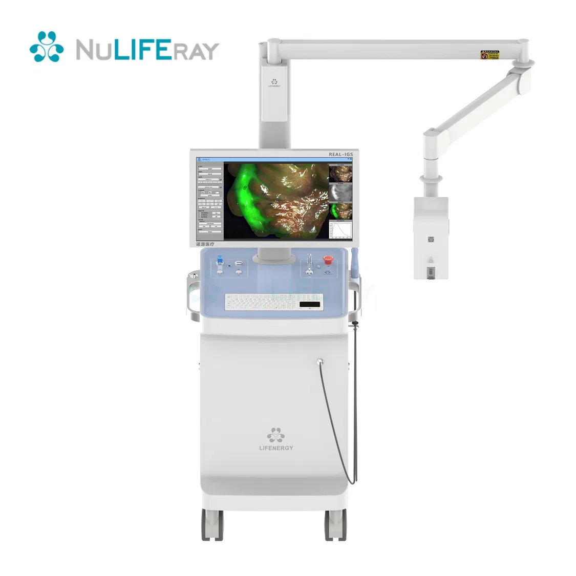 Advanced Fluorescence Imaging Solution for Precise Breast Surgery