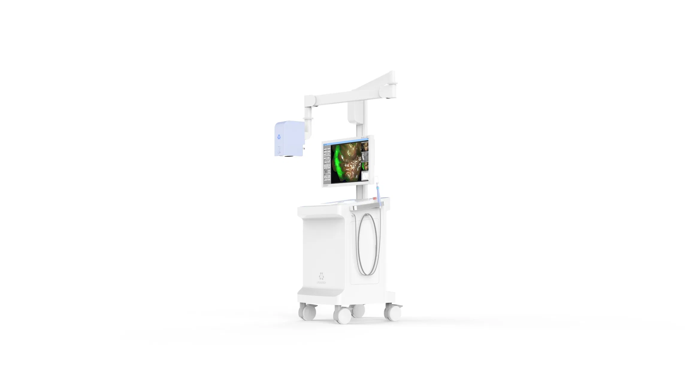 Advanced Fluorescence Imaging Solution for Precise Breast Surgery